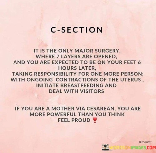C-Section-It-Is-The-Only-Major-Surgery-Where-7-Layers-Quotes.jpeg